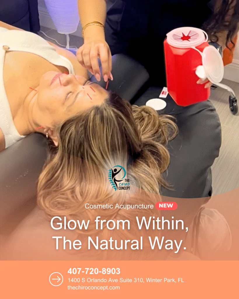 Choosing Acupuncture Over Botox